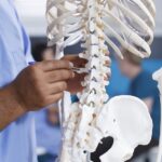 Explores Spinal Compression Fractures